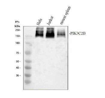 Western blot analysis of PIK3C2B using anti-PIK3C2B antibody. Electrophoresis was performed on a 8%