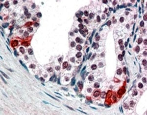 IHC testing of FFPE human prostate shows nuclear staining in secretory epithelial cells. SMARCE1 ant