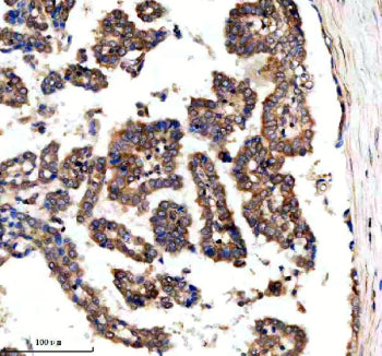 Immunohistochemical staining of SRBD1 using anti-SRBD1 antibody. SRBD1 was detected in a paraffin-em