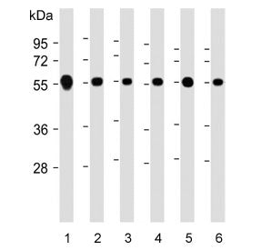 Western blot testing of human 1) Jurkat, 2) HeLa, 3) K562, 4) SH-SY5Y, 5) Ramos and 6) A549 cell lys