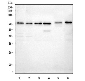 Western blot testing of 1) human HaCaT, 2) human A431, 3) human A549, 4) human MCF7, 5) rat C6 and 6