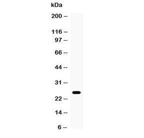 Western blot testing of mouse thymus tissue with TNF alpha antibody at 0.5ug/ml. Predicted molecular