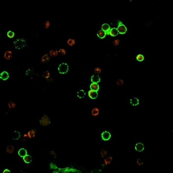 Immunofluorescent staining of human PBMC with recombinant CD4 antibody (clone rC4/206, green).