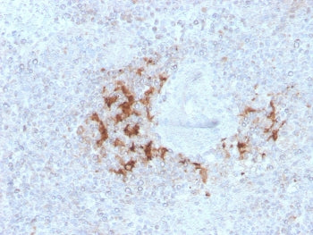 IHC staining of FFPE human spleen with TRAF1 antibody (clone TRAF1/3298). HIER: boil tissue sections
