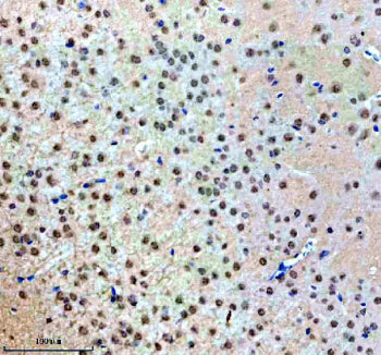 Immunohistochemical staining of NUP93 using anti-NUP93 antibody. NUP93 was detected in a paraffin-em