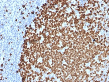 IHC testing of FFPE human tonsil stained with Ki67 antibody (MKI67/2461). Required HIER: boiling tis