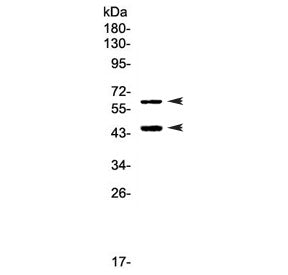 TIM-3 Antibody / HAVCR2