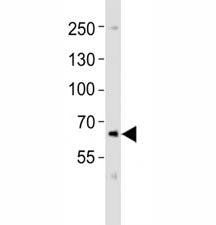 PCSK9 Antibody