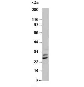PLGF Antibody