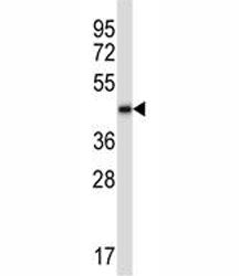 BMP2 antibody western blot analysis in human CEM lysate. Expected molecular weight: 13-14 kDa per mo