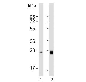 Western blot testing of human 1) liver and 2) ovary lysate with NTF3 antibody. Predicted molecular w