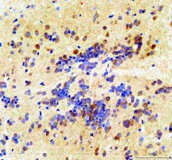 IHC staining of FFPE zebrafish brain tissue with Zebrafish Csnk2b antibody, HRP secondary and DAB su