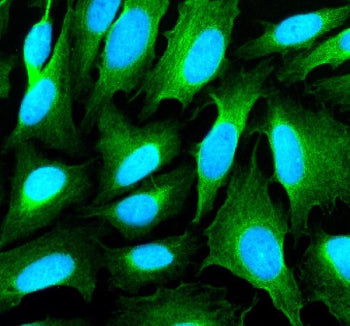 Immunofluorescent staining of SHANK1 using anti-SHANK1 antibody (green). SHANK1 was detected in an i