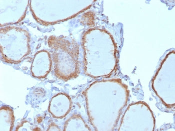 IHC staining of FFPE human thyroid tissue with TrkB antibody (clone NTRK2/7928). HIER: boil tissue s
