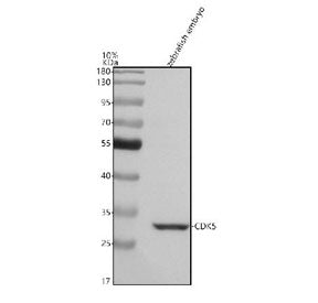 Western blot analysis of Cdk5 protein using Cdk5 antibody and zebrafish embryo tissue lysate. The pr