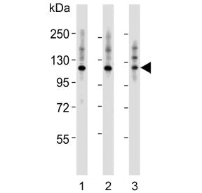 Western blot testing of human 1) HeLa, 2) A431 and 3) Jurkat cell lysate with Integrin alpha 7 antib