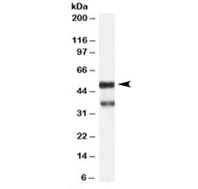 PACSIN1 Antibody