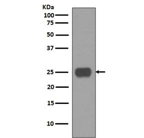 Western blot testing of human fetal brain lysate with CD90 antibody. Expected molecular weight 18~35