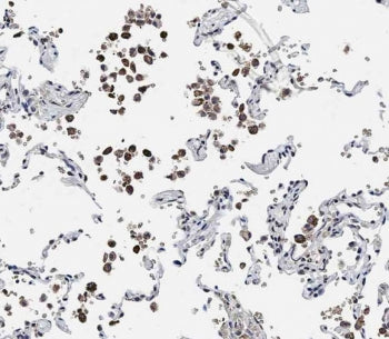 IHC testing of FFPE human lung tissue with ADAMTS17 antibody. HIER: steam section in pH9 EDTA for 20