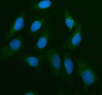 CDC25B Antibody