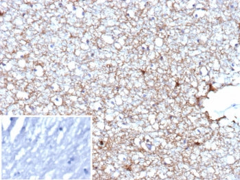 IHC staining of FFPE human brain tissue with Glial fibrillary acidic protein antibody (clone GFAP/94