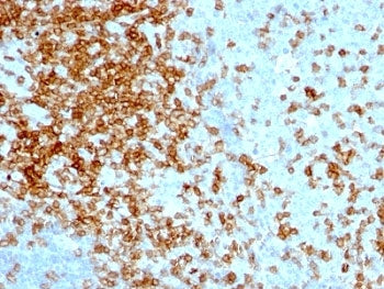 IHC analysis of formalin-fixed, paraffin-embedded human tonsil stained with CD43 antibody (clone 84-