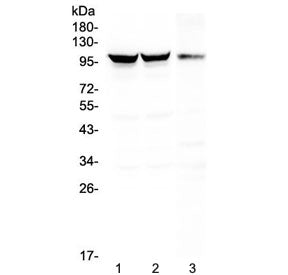 Western blot testing of 1) rat brain, 2) mouse brain and 3) mouse NIH3T3 lysate with Dynamin 1 antib
