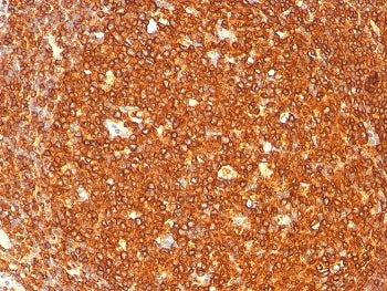 IHC staining of FFPE human tonsil with HLA-DRB1 antibody (clone SPM289). HIER: boil tissue sections