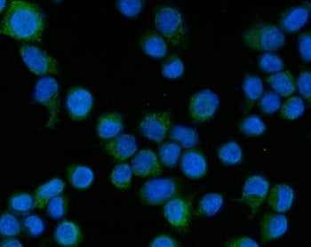 Immunofluorescent staining of FFPE human SiHa cells with TAK1 antibody (green) and DAPI nuclear stai