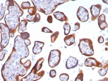 Glypican 3 Antibody / GPC3