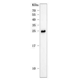 Western blot testing of rat liver tissue lysate with Ang antibody. Predicted molecular weight ~16 kDa.
