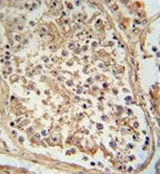 GTPBP2 Antibody