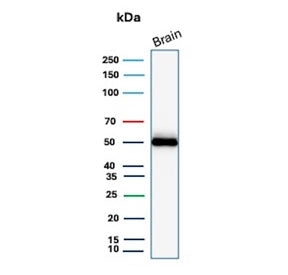 Western blot testing of human brain tissue with GFAP antibody (clone GFAP/9423). Predicted molecular