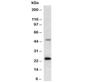 Western blot testing of human MCF-7 cell lysate with recombinant Mammaglobin A antibody (clone MMGA-