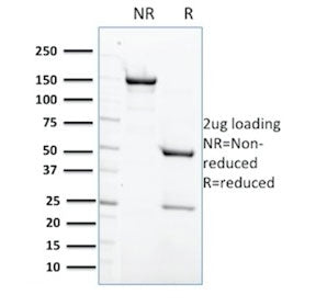 SHP-1 Antibody / PTPN6