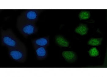Immunofluorescent staining of FFPE human SiHa cells with KLF10 antibody (green) and DAPI nuclear sta
