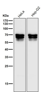 All lanes use the PICALM antibody at 1:3000 dilution for 1 hour at room temperature. Western blot an
