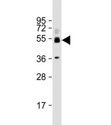 SH3BP5 Antibody / SAB