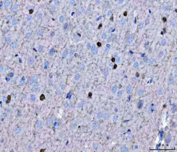 IHC staining of FFPE rat brain tissue with TWIST1/2 antibody. HIER: boil tissue sections in pH8 EDTA