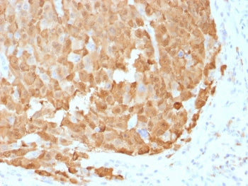 S100A1 Antibody