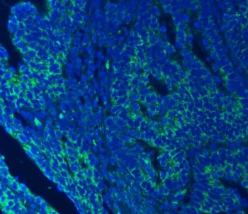 Immunofluorescent staining of FFPE human colorectal cancer with SEC23IP antibody (green) and DAPI nu