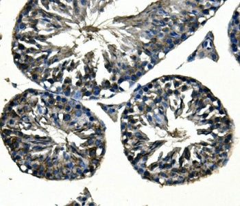 IHC staining of FFPE rat gastric tissue with Adam28 antibody. HIER: boil tissue sections in pH8 EDTA