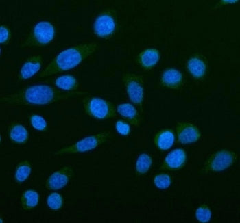 Immunofluorescent staining of FFPE human SiHa cells with NOX5 antibody (green) and DAPI nuclear stai