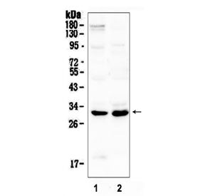 IL1 beta Antibody