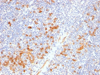 IHC staining of FFPE human tonsil with recombinant CD123 antibody (clone IL3RA/2947R). HIER: boil ti