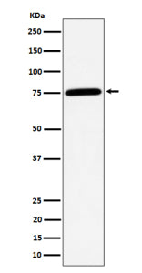 Western blot analysis of PPM1G expression in human Jurkat cell lysate using PPM1G antibody. Predicte
