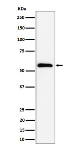 Western blot analysis of PNK / PNKP expression in human HeLa cell lysate using PNKP antibody. Predic