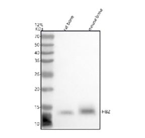 Western blot analysis of HBZ using anti-HBZ antibody. Lane 1: rat bone tissue lysates, Lane 2: mouse