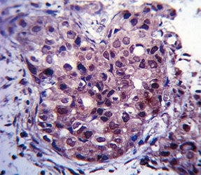 Estrogen Receptor antibody immunohistochemistry analysis in formalin fixed and paraffin embedded hum