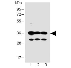 Western blot testing of human 1) SH-SY5Y, 2) PANC-1 and 3) MCF-7 cell lysate with OR5V1 antibody at